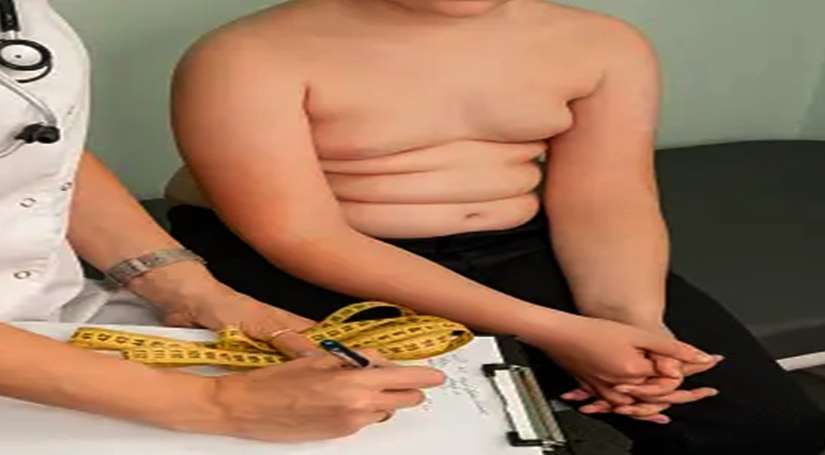 जल्‍द उपचार से बच्चों के मोटापे को रोकने में मदद मिल सकती है: अध्ययन