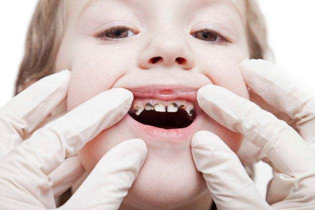 Teeth Diseases: दांतों के दर्द से राहत पाने के घरेलू और कारगर उपाय