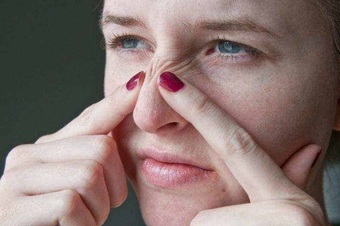 Pimples Tips : ब्लैकहेड्स से छुटकारा पाने के लिए इन टिप्स को आजमाएं