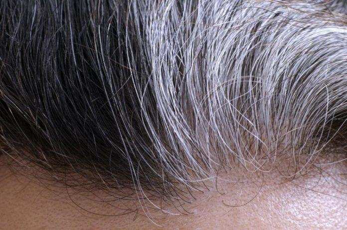 जानिए बालों के समय से पहले सफेद होने का कारण