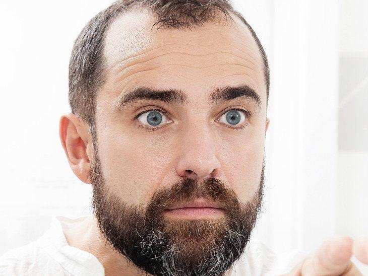 समय से पहले दाढ़ी मूंछ सफेद होने से परेशान है? अपनाइए ये असरदार तरीके