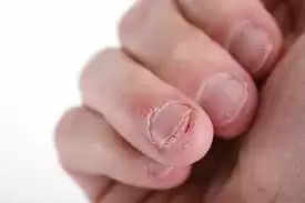 Omicron Syntoms, अगर आपके Nails और Skin में हो रहा है इस तरह का बदलाव तो हो जाएं सावधान
