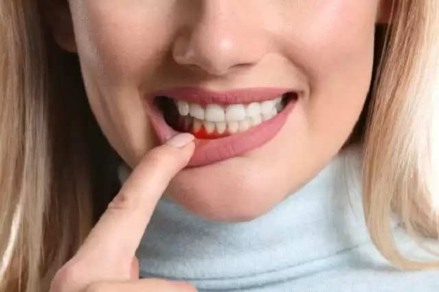 अगर आपके भी दांतों पर मसूड़ों की पकड़ हो रही है ढीली, तो बडे काम आ सकती है ये होम टिप्स