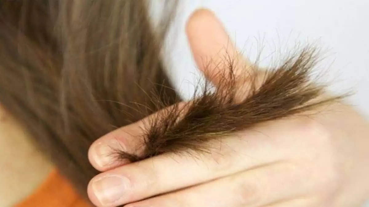 Hair Care : झड़ते बालों को रोकने के लिए आजमाएं ये नेचुरल ऑयल, बाल होंगे मजबूत और घने