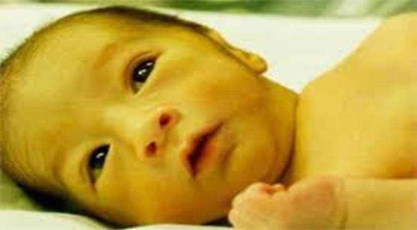 पीलिया की देखभाल: यहाँ नवजात शिशुओं में पीलिया का क्या कारण है
