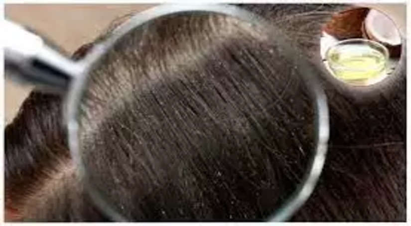 अगर आपके बालों पर भी होता चीजों से साइड इफेक्ट, तो इस चीज का करें इस्तेमाल कभी नहीं होगी समस्या