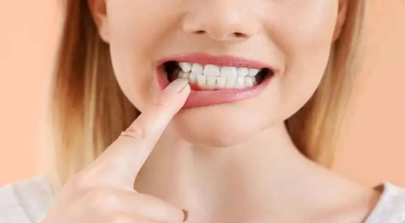अगर आपके भी दांतों पर मसूड़ों की पकड़ हो रही है ढीली, तो बडे काम आ सकती है ये होम टिप्स